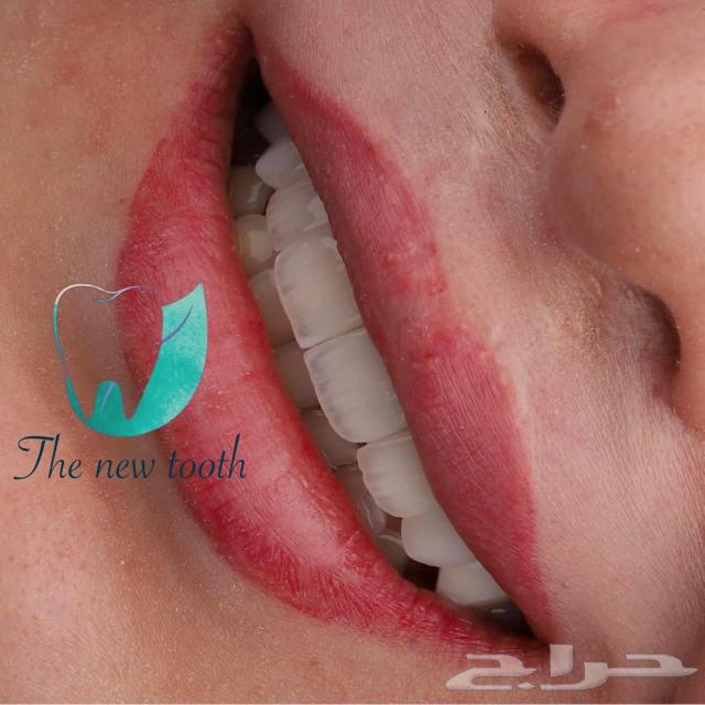 ابتسامه هوليود63189838727171111