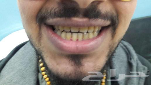 Hiliod's German smile63186472809090111