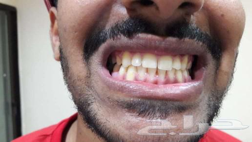 Hiliod's German smile63186472809090112