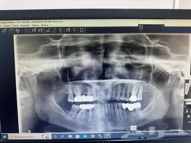 Panoramic and cephalometric Vatech Korean device model 202163242422145409112