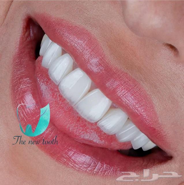 ابتسامة هوليوود63158550423811112