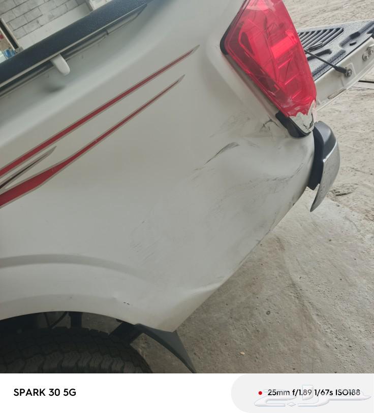 شفط وتعديل صدمات بدون بويه63218346678786112