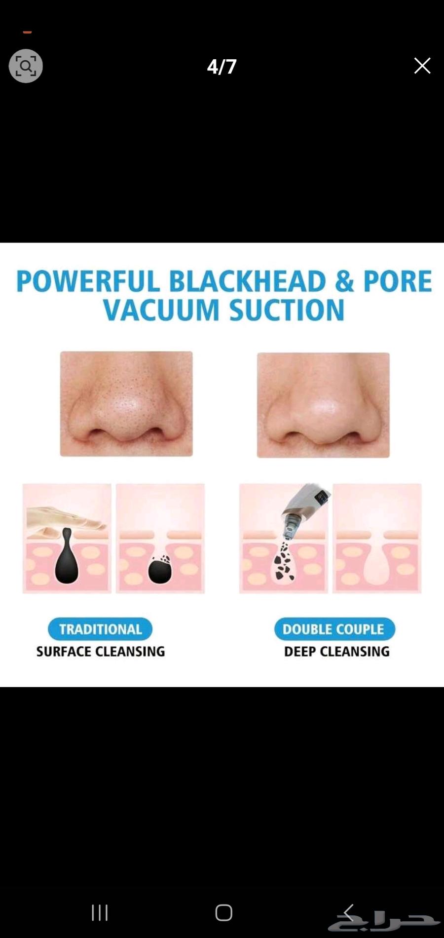 Blackheads and fat suction device63099323953667111