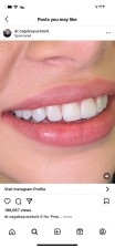 عروض حصريه وقوية ع ابتسامة هوليود63470381248259111