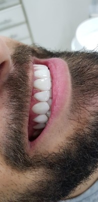 عروض حصريه وقوية ع ابتسامة هوليود634703812482591112