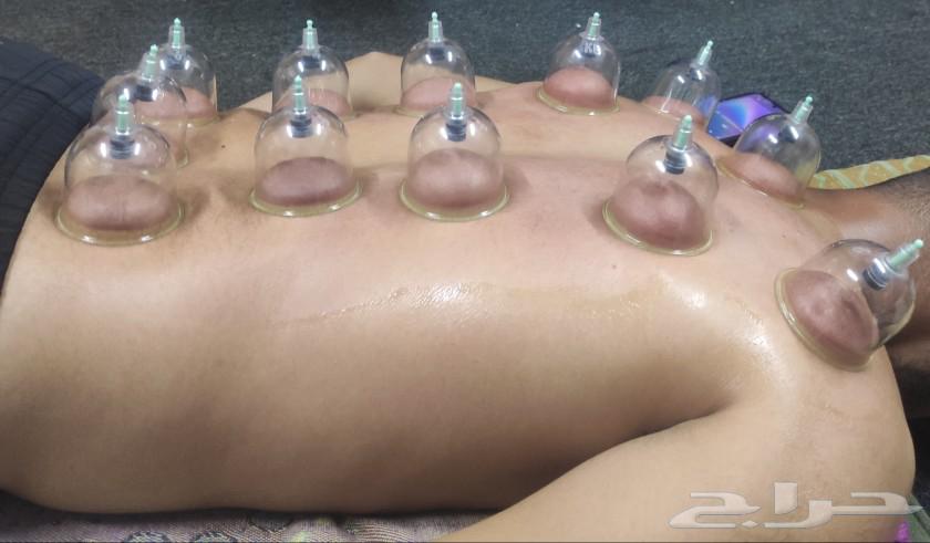 Home cupping specialist with extensive experience of more than 5 years63104192122369111