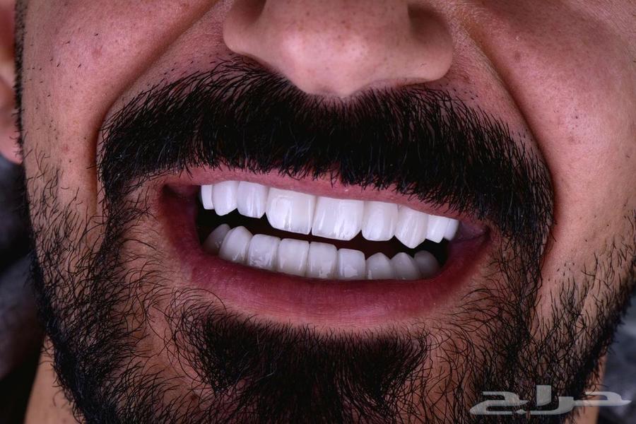 ابتسامة هوليوود ايماكس الألمانية63032728686209111