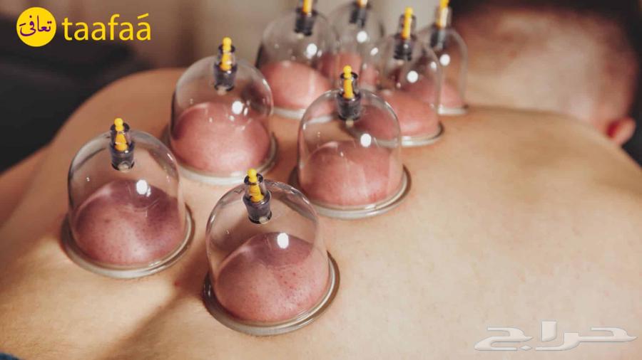 Sports and Therapeutic Massage with Cupping Therapy63611966754050113