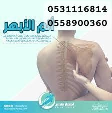 متواجد بخميس مشيط معالج الابهر وعرق النساء وحتكاك الركب64371540732929110