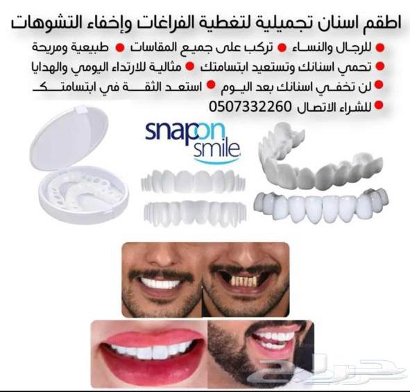 للبيع تلبيسات اسنان تجميليه بأسعار مناسبة64465507412481110