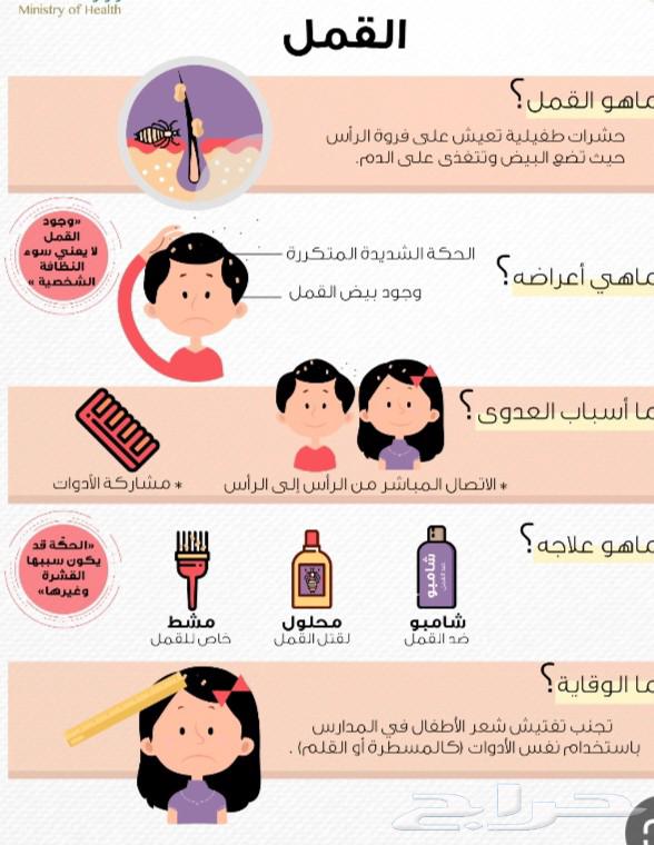 زيت صنع طبيعي باعشاب للقمل اصلي الجوده64497648351362112