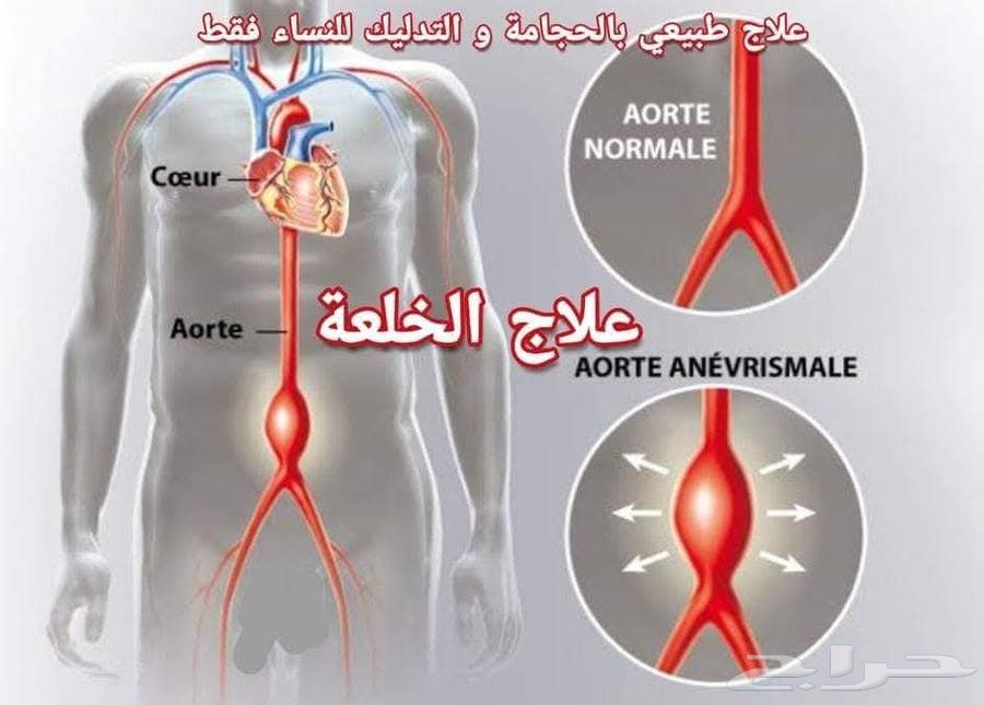Dislocation and cupping64514210135043110