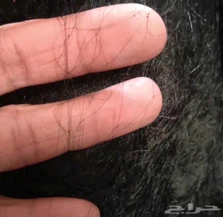 Bird hunting net64529576722946112