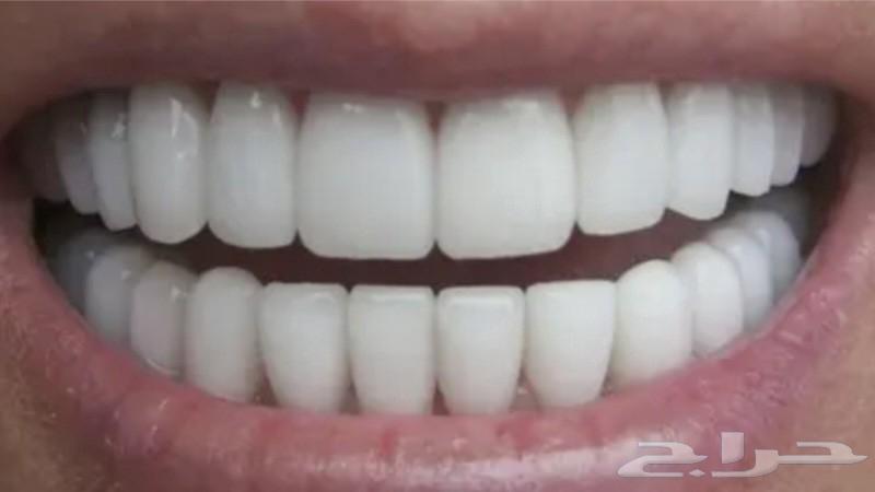 ابتسامة فاخرة... عروض خاصة64570764460675110