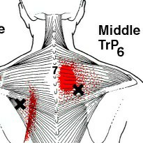 The Sciatica64540266543873110