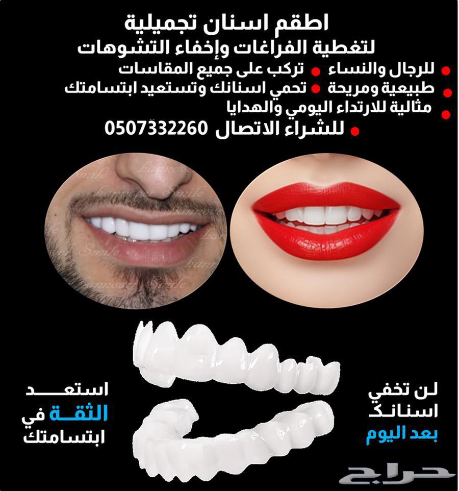 للبيع تلبيسات اسنان تجميليه بسعر مغري64443317478530110
